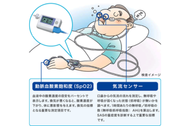 睡眠ポリグラフ検査(PSG)簡易検査