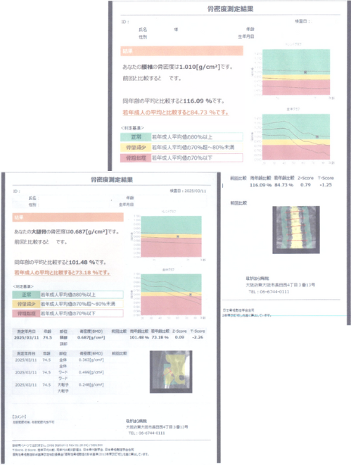 DEXA(骨密度検査)